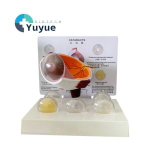 Modelo Anatómico Ampliado del Ojo Humano con 5 <span class=keywords><strong>Tipos</strong></span> <span class=keywords><strong>de</strong></span> Lentes <span class=keywords><strong>de</strong></span> Catarata para <span class=keywords><strong>la</strong></span> Enseñanza <span class=keywords><strong>de</strong></span> Oftalmología - Product Image 1