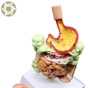 العلوم الطبية التشريحية نموذج الأمعاء المعوية المرضية والمعدة - Product Image 5