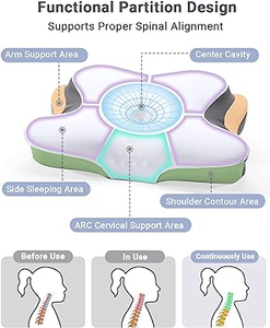 Bantal serviks bantal busa memori untuk nyeri leher, bantal penopang leher ortopedi ergonomis untuk sisi - Product Image 2