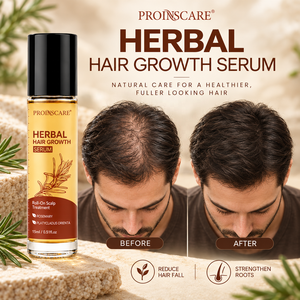 Siero per la Crescita dei <span class=keywords><strong>Capelli</strong></span> di Alta Qualità con Formula UK, Migliora la Ricrescita dei <span class=keywords><strong>Capelli</strong></span>, con Rosmarino e Adenosina, Siero Avanzato per la Crescita Rapida dei <span class=keywords><strong>Capelli</strong></span> OEM per Uomini - Product Image 1