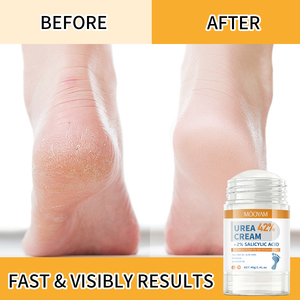 Crema per Piedi Biologica OEM/ODM con Etichetta Privata, Stick Idratante con 42% di Urea, Riparatore per <span class=keywords><strong>Pelle</strong></span> <span class=keywords><strong>Secca</strong></span> e <span class=keywords><strong>Talloni</strong></span> Screpolati - Product Image 3