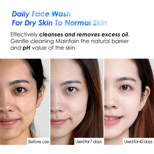 Desmaquillador de limpieza profunda de aminoácidos suaves de pH bajo, limpiador Facial de ácido débil para el cuidado diario de la piel o desmaquillador - Product Image 6
