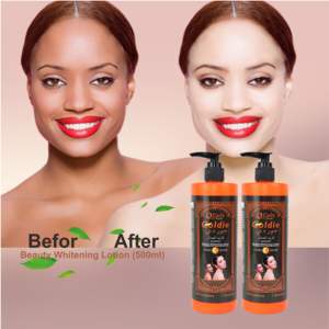 Neue Großhandel Body Cream O'Carly – Goldie Beauty Feuchtigkeitscreme gegen Sommersprossen und zur Hautaufhellung - Product Image 4