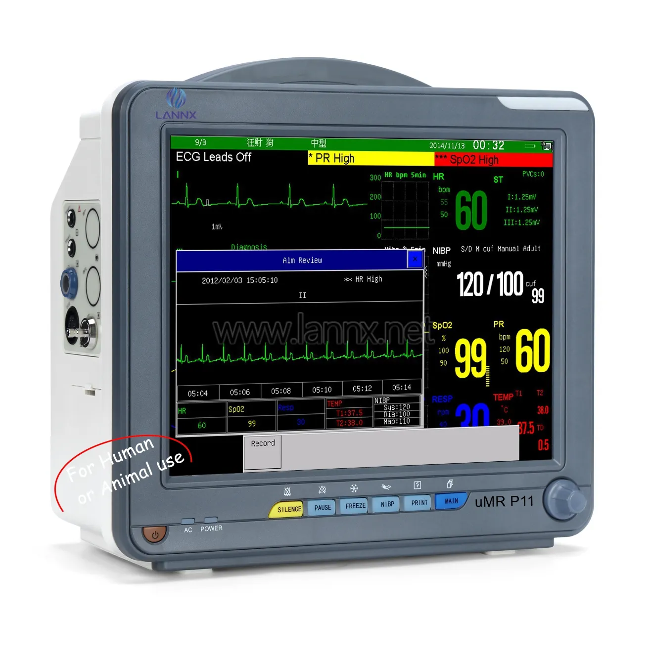 Lannx umr P11 OEM ODM holter ECG giám sát con người hoặc động vật sử dụng quan trọng dấu hiệu màn hình y tế đa Thông số icu tim màn hình
