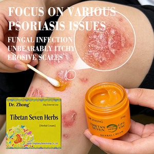 Crema anti-picazón puramente natural a base de plantas, adecuada para afecciones de la piel como picaduras de mosquitos, alergias, <span class=keywords><strong>dermatitis</strong></span>, etc. - Product Image 1