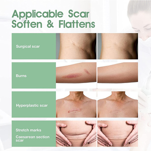 Ruban adhésif en gel <span class=keywords><strong>de</strong></span> <span class=keywords><strong>silicone</strong></span> professionnel à prix avantageux pour les cicatrices - Product Image 5