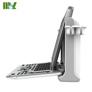 CHISON Ebit50 Medische Echografie-apparaat met <span class=keywords><strong>Trolley</strong></span> Instrumenten MSK Vasculair 4D Digitale <span class=keywords><strong>Trolley</strong></span> Kleuren <span class=keywords><strong>Doppler</strong></span> Echografie - Product Image 3