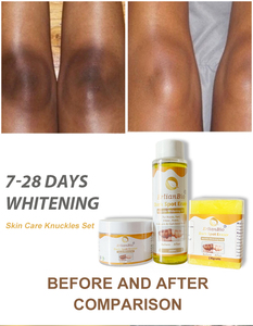 Etiqueta privada Cuerpo Nudillos Productos para blanquear las axilas Aclarar la melanina Vitamina C Brillo e hidratante Conjunto para el cuidado de la piel - Product Image 3