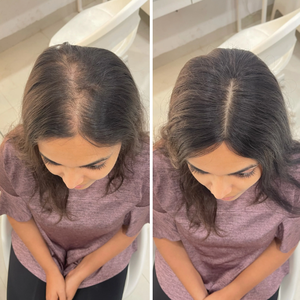 Rare Topper en Soie Naturelle Colorée Fait Main, 100% <span class=keywords><strong>Cheveux</strong></span> Humains pour une Couverture Capillaire Parfaite - Product Image 5