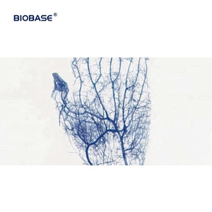 เครื่องค้นหาเส้นเลือดทางการแพทย์แบบพกพาเครื่องค้นหาเส้นเลือดทางการแพทย์แบบ Biobase ประเทศจีน - Product Image 4