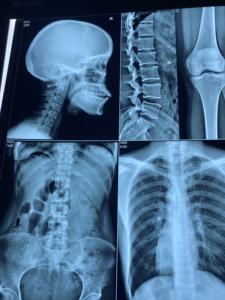 Mürekkep püskürtmeli yazıcı için kullanılan yüksek hızlı <span class=keywords><strong>x-ray</strong></span> <span class=keywords><strong>film</strong></span> boyutu 10x12 ilaç kuru <span class=keywords><strong>film</strong></span> - Product Image 4