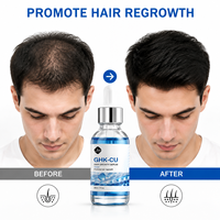 Private Label AHK-Cu Kupferpeptid Haarwuchsserum GHK-Cu Kupferpeptid-Serum für Haarwachstum bei Haarausfall und -verdünnung