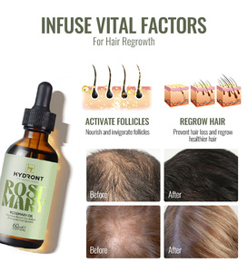 Private Label Kooswalla 100% naturale puro olio di rosmarino effetto rapido prodotti per la perdita di capelli per donne e uomini neri - Product Image 4