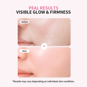 Mascarilla Facial de Cristal Rosa PDRN de Marca OEM Personalizada, Paquete de 4 Unidades para Hidratación Facial y Resistencia a las Arrugas - Product Image 4
