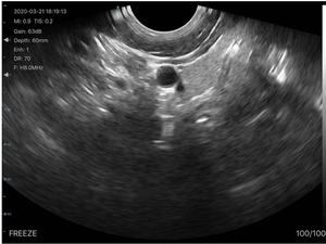 B26D二重妇人科超音波凸および产科医および产科医のための経膣 - Product Image 5