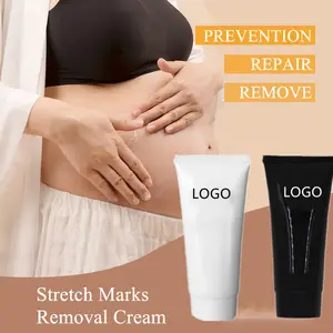 Krim Penghilang Selulit dan Stretch Anti Stretch Mark, Krim Hamil Membantu Bekas Luka dan Pencegahan untuk Kehamilan