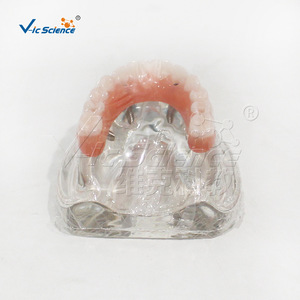 Modèle de Restauration d'Implant Maxillaire M6001-1, Structure de Prothèse Dentaire Démontable, Aide Pédagogique pour la Formation Dentaire - Product Image 2