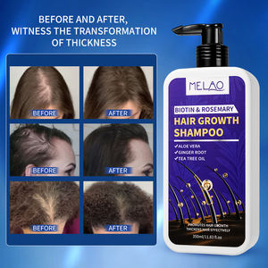 แชมพูบำรุงหนังศีรษะและเร่งการเจริญเติบโตของเส้นผมไบโอตินโรสแมรี่ แบรนด์ไพรเวทเลเบล สำหรับการดูแลเส้นผม - Product Image 5