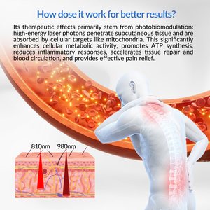 Dispositivo <span class=keywords><strong>de</strong></span> Terapia <span class=keywords><strong>de</strong></span> Luz Roja Infrarroja OEM para Fisioterapia, Tratamiento Frío para Dolor Muscular en Perros, <span class=keywords><strong>Veterinaria</strong></span> <span class=keywords><strong>Cerca</strong></span> <span class=keywords><strong>de</strong></span> <span class=keywords><strong>Mí</strong></span> - Product Image 2