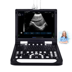 Mesin <span class=keywords><strong>Ultrasound</strong></span> medis, pemindai <span class=keywords><strong>Ultrasound</strong></span>/ultrasonografi diagnostik mesin <span class=keywords><strong>Ultrasound</strong></span> medis harga bagus - Product Image 1