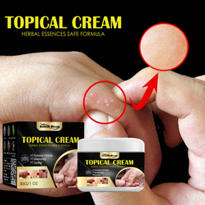 South Moon Sweat Blister Crème anti-démangeaisons pour peau sèche contre les piqûres de moustiques - Product Image 1