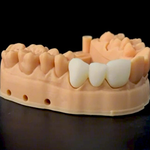 Resina Bio-Nano Ceramica Over-Crown per Corone e Ponti Dentali Stampati in 3D, Purezza 100%, Durata 36 Mesi - Product Image 5