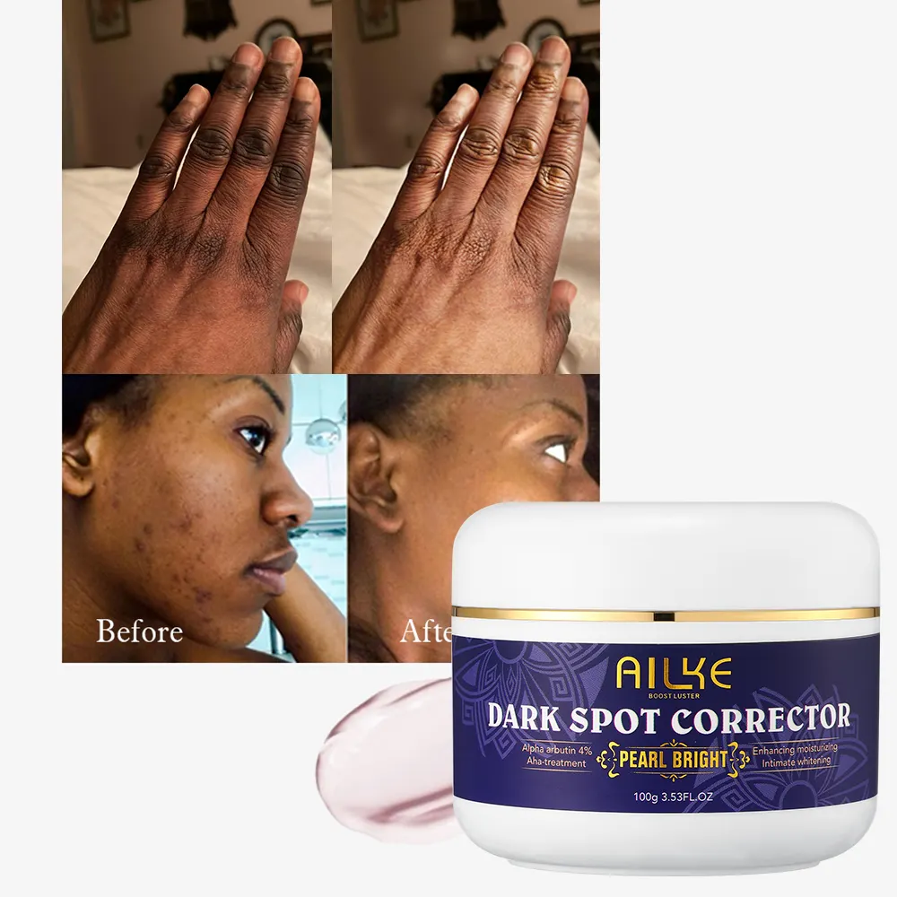 AILKE Private Label Organic Anti Aging Wrinkle Acne Nicotinamide Bleaching Dark Spot Remover Black Skin Whitening Face Cream