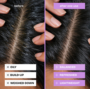 Barra de Champú Clarificante para Cuero Cabelludo Graso, Champú Sólido de Limpieza Profunda, Controla la Grasa, Elimina la Acumulación, Refresca el Cabello - Product Image 3