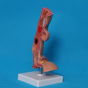 Modelo Anatómico del Esófago del Sistema Digestivo para Entrenamiento Médico MAXCARE MAC-YJ84 para Hospitales y Centros de Enseñanza - Product Image 2