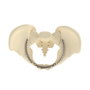 CANWELL CE/ISO gecertificeerde roestvrijstalen orthopedische trauma 3,5 mm bekkenvergrendelingsplaat gebogen botfixatie implantaat anatomisch - Product Image 2