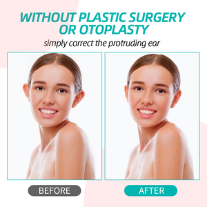 Corrector de oreja para adultos y niños, caja de 8 Uds., productos correctivos para el cuidado de los oídos, <span class=keywords><strong>pegatinas</strong></span> para fijar las <span class=keywords><strong>orejas</strong></span> - Product Image 2