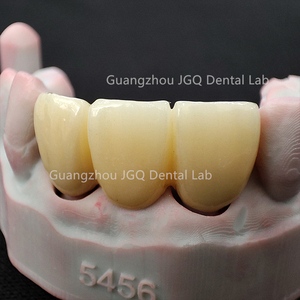 Couronnes en zircone solide avec <span class=keywords><strong>porcelaine</strong></span> Built-up Full Service China Dental Lab <span class=keywords><strong>Prix</strong></span> - Product Image 3