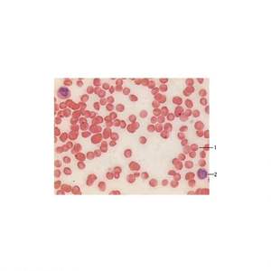 KS-16 Sangue de cavalo esfregaço - Product Image 1