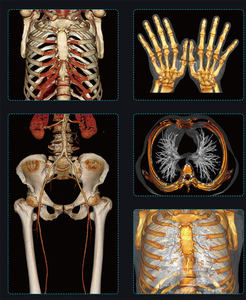 24列32スライスCTスキャン装置、人間用、現場設置、専門アフターサービスチーム - Product Image 6