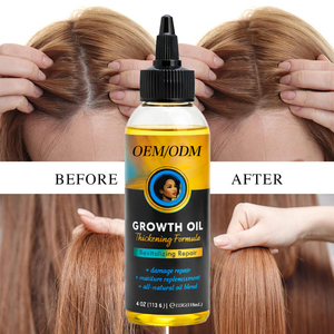 Tratamiento para la Caída del Cabello, Marca Privada OEM/ODM, Suero Natural Orgánico 2 en 1 para Engrosar el Cabello, Aceite para el Crecimiento, Hidratante y Revitalizante - Product Image 4