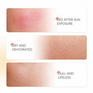 Loción Corporal al por Mayor de Fabricante OEM/ODM con Aloe Vera y Ácido Hialurónico - Hidratante y Calmante para Aliviar Quemaduras Solares - Product Image 4