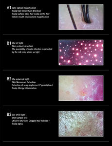 Analizador de Piel y Cuero Cabelludo <span class=keywords><strong>Magic</strong></span> Mirror 2026, Probador de Cuero Cabelludo con 2 Sondas, Detector de Arrugas, Pigmentación, Folículos, Acné, Piel y Cabello - Product Image 5