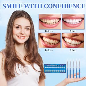 12 pièces de gels blanchissants doux pour usage dentaire, avec cartes de nuancier dentaire et gouttières, pour un effet blanchissant exceptionnel, confortables et pratiques pour un usage quotidien - Product Image 5