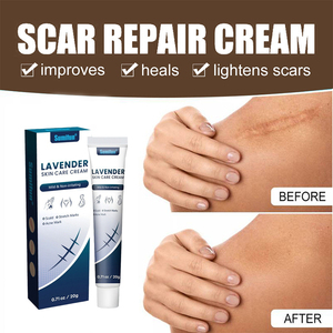 <span class=keywords><strong>Crema</strong></span> Rimozione Cicatrici da Acne Più Rapida, Gel <span class=keywords><strong>per</strong></span> Cicatrici, <span class=keywords><strong>Crema</strong></span> Riparatrice <span class=keywords><strong>per</strong></span> Contusioni, <span class=keywords><strong>Crema</strong></span> Rassodante <span class=keywords><strong>per</strong></span> Addome, <span class=keywords><strong>Crema</strong></span> Rimozione Smagliature - Product Image 3