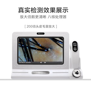Smart 11 Inch Double Probe HD Lcd Hair Follicles Scalp Scanner Detector Analyzer Analysis Camera Detect Microscope <strong>Tester</strong> - Product Image 1