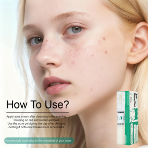 Крем-гель для лица с травами против акне и следов от прыщей, осветляющий тусклую кожу - Product Image 4