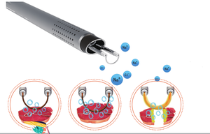 Tıbbi düşük. TEMP plazma jeneratör cerrahi sistemi/Bipolar ctoctosystem sistemi - Product Image 3