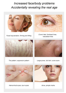 <span class=keywords><strong>Appareil</strong></span> professionnel Scarlet pour le blanchiment et la régénération de la peau, la gestion des rides et des ridules, machine faciale - Product Image 3