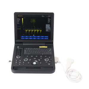 Máquina de Ultrasonido Veterinaria Portátil de 15 Pulgadas en Blanco y Negro con Doppler PW para Abdomen, Obstetricia/Ginecología, Cardiología - Product Image 6