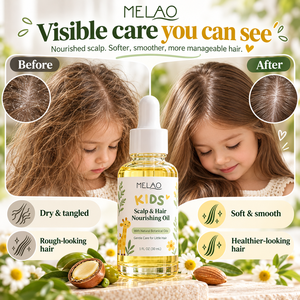 Aceite Capilar Infantil con Logotipo Personalizado, Aceite Nutritivo para el Cuero Cabelludo de Niños, Fórmula Botánica Ligera, Cuidado Capilar Suave y Delicado, Aceite Capilar para Niños - Product Image 5