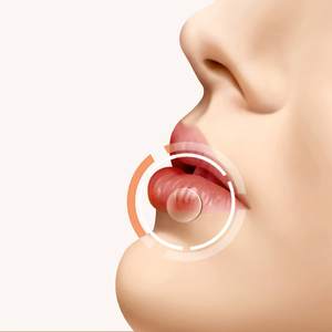 Plester Hidrokoloid Oral Baru untuk Sariawan, Perekat Lembut dan Perawatan Aman untuk Bibir, Perlengkapan Medis - Product Image 1