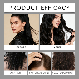 Herbicos Aceite para el cuidado del cabello Romero Jengibre y extracto de hierbas Fortalecimiento de las raíces del cabello Mejora la sequedad Frizz Productos para el cuidado del cabello - Product Image 6