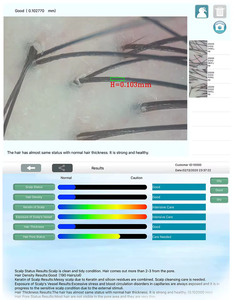 เครื่องวิเคราะห์ผิวและเส้นผมแบบพกพาขายดีที่สุด พร้อมหน้าจอแบ่งสี่ส่วน บันทึกภาพได้ หน่วยความจำขนาดใหญ่ สำหรับใช้ในร้านเสริมสวย - Product Image 3