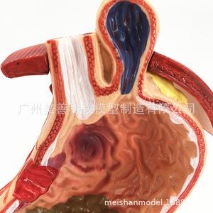 Modèle de simulation pédagogique d'estomac pathologique, modèle d'anatomie d'estomac pathologique, spécimens d'anatomie viscérale et un autre modèle. - Product Image 3