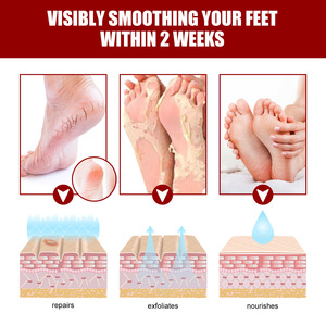 Masque exfoliant pour les pieds à l'acide de fruits végétalien naturel personnalisé avec logo - Product Image 5